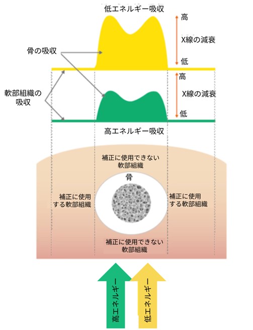 Technical Tips_Photon Counting01.jpg